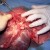 Another lung lobe. Another lung lobe.