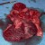 Dissection reveals greatly enlarged right ventricle and atrium Dissection reveals greatly enlarged right ventricle and atrium