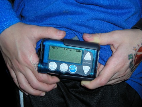 Here is Spencer's pump, the blue Medtronic Paradigm