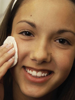 Treat acne vulgaris with aloe vera cream