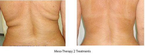courtesy of http://www.totaldermatology.com