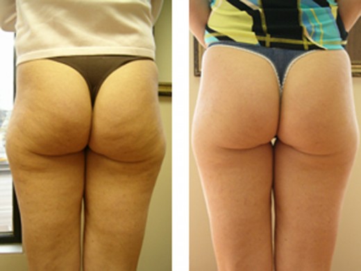 courtesy of http://www.houstonhealthandbeauty.com