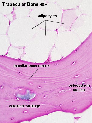A microscopic image of trabecular bone and its surrounding matrix.