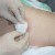 Sometimes if the wound edge is very uneven or inflamed, aquaflo can be cut and placed around the wound to protect the skin. ( We do not show this in this picture) Another product used to protect surrounding skin is duoderm. After the wound has been c Sometimes if the wound edge is very uneven or inflamed, aquaflo can be cut and placed around the wound to protect the skin. ( We do not show this in this picture) Another product used to protect surrounding skin is duoderm. After the wound has been c