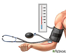 Checking hypertension lever or high blood pressure -- cure can be the done the naturopathy way