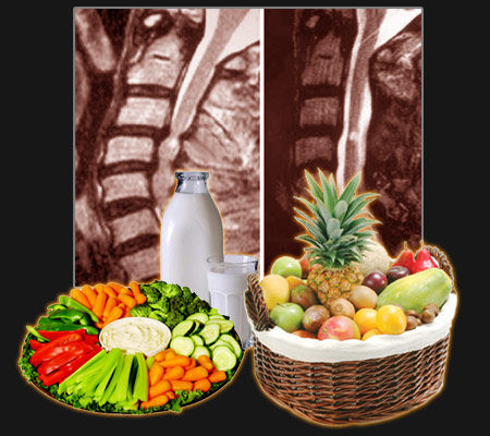 Diet is a big part of naturopathic therapy