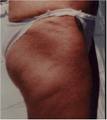 Before Target Toning thighs and buttocks