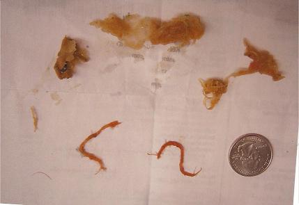 Parasites that have been flushed out after colon cleansing.