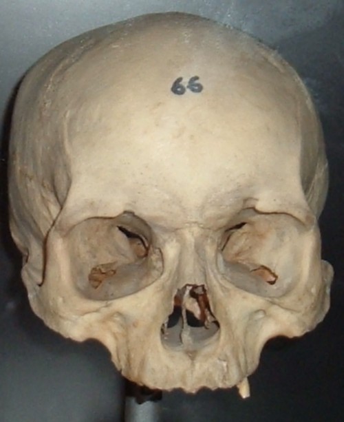 Guanche skull