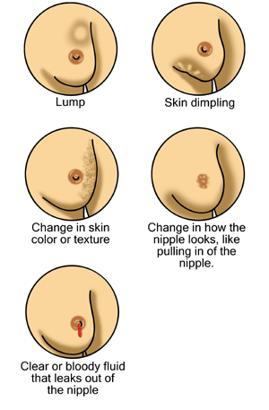 Pay attention to any changes within the appearance and/or health of your breast