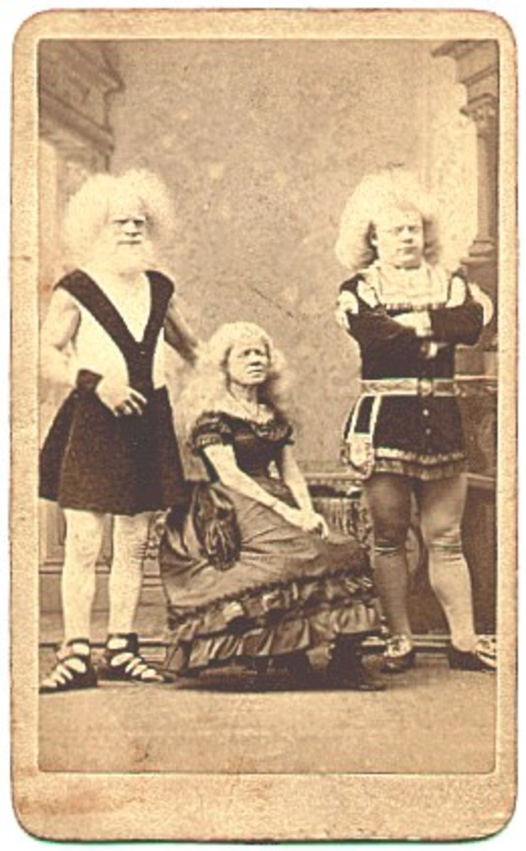 Rudolph Lucasie & familiy, African albinos. PT Barnum found them in Amsterdam in 1857. He brought them to America to become the most popular "living curiosities." Barnum billed them as black Madagascans that slept with their pink eyes wide open. They