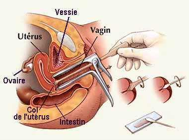 Pap smear for detection of cervical abnormalities in women.