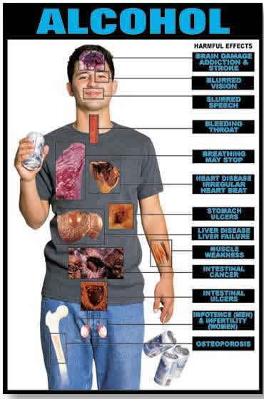 Alcoholic liver disease is the major cause of liver disease in Western countries