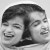 Iranian conjoined twins Iranian conjoined twins