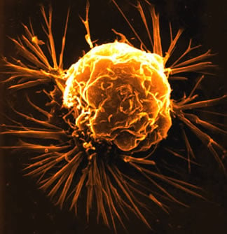 They may look pretty, but they are deadly cancer cells