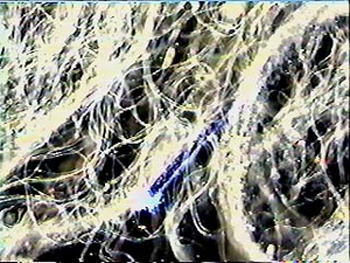 Some say these are chemtrail fibers. Handling them will give you Morgellon's disease.