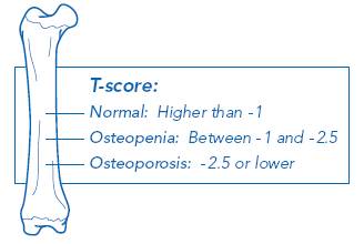 Interpreting Bone Density T Score