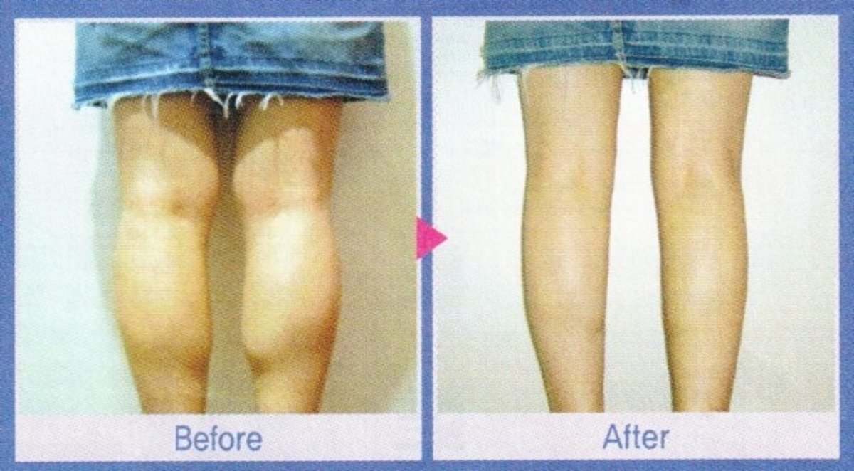 How can I slim down muscular legs?