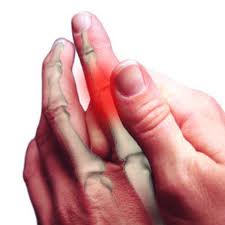 Peripheral neuropathy of hand nerves