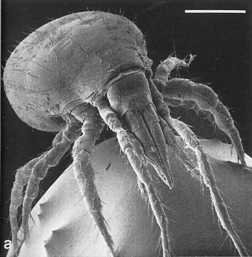 Picture of a dust mite