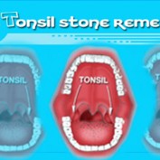 tonsilstoneremedy profile image