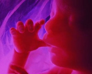 MILLIONS ON TOP OF MILLIONS OF BABIES KILLED