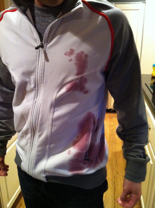 Before: The huge Zinfandel stain on my brother-in-law's white jacket.