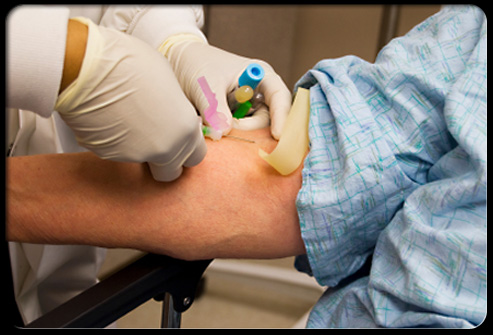 A newer, more specific blood test for rheumatoid arthritis is the citrulline antibody test.