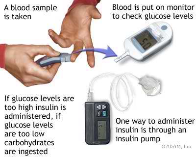 How to administer Insulin