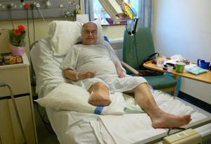 leg amputation due to peripheral vascular disease