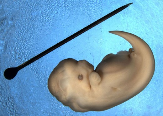 Dolphin's embryo
