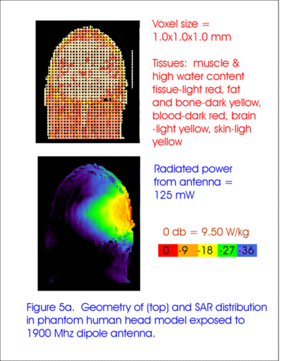 Cell phone radiation to head. (Image credit: ObsidianOrder thru WikiMedia Commons)