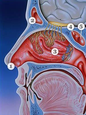 The anatomy of the nose showing the different sinuses:frontal sinuses, maxillary sinuses,ethmoid sinuses,and sphenoid sinuses. Sinuses are air-filled pockets once filled with mucus and become infected cause pain and congestion.