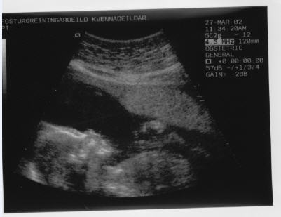HubPages profile picture for @parents