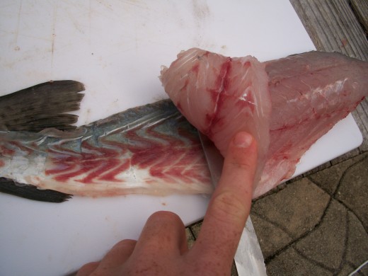 #10 Examination of skinning