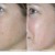 before & after pictures before & after pictures