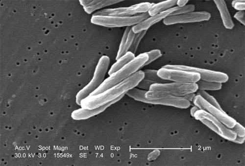 myobacterium tuberculosis