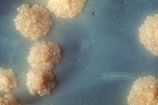myobacterium tuberculosis