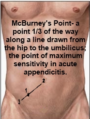 Diagram of McBurney's Point