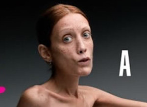 Isabella Caro was a model who became an anti-anorexic spokesperson. She posed in shocking Italian ads to warn people of eating disorders