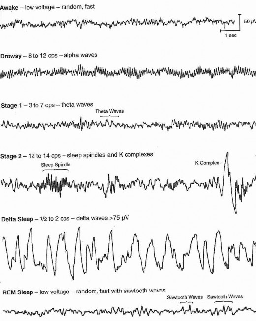 4751183 F520 Jpg 520 653 Pixel Neurologie Schlafmedizin Psychologie