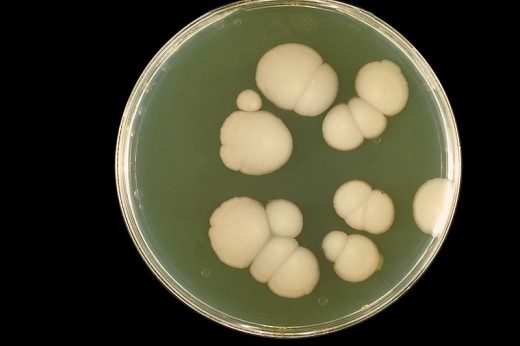 A candida albicans culture, commonly known as thrush