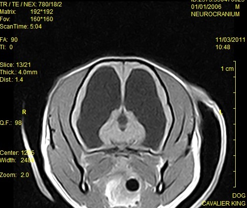 MRI scan of a Cavalier King Charles Spaniel with hydrocephalus.