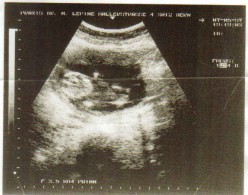 A New Life in Me - The Miracle of Pregnancy