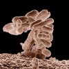 Escherichia or E. coli - Intestinal Flora and Bacterial Infection