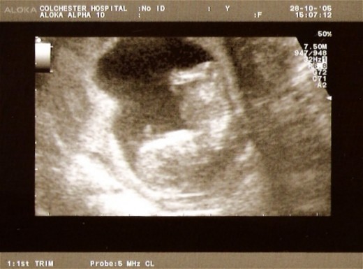 I reckon I have a 25% to 50% chance of getting pregnant according to the stats of my facebook friends.