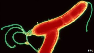Helicobacter pylori under the microscope