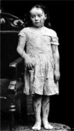 Mary Ellen Wilson-America's First Recognized Child Abuse Case