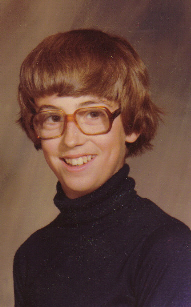 This is the way my hair looked during that painful summer when puberty raged its ugly head.