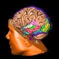 Understanding Brain Injuries